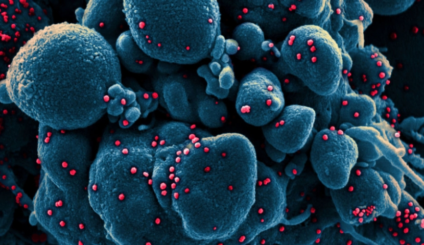 3 მილიონი ბავშვის სიკვდილი ანტიბიოტიკებისადმი რეზისტენტულ ინფექციებს უკავშირდება - ახალი კვლევა